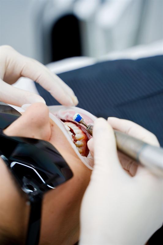 Mondhygiëniste tijdens een professionele gebitsreiniging
